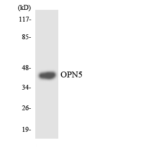 OPN5 / Neuropsin Antibody - Western blot analysis of the lysates from HUVECcells using OPN5 antibody.