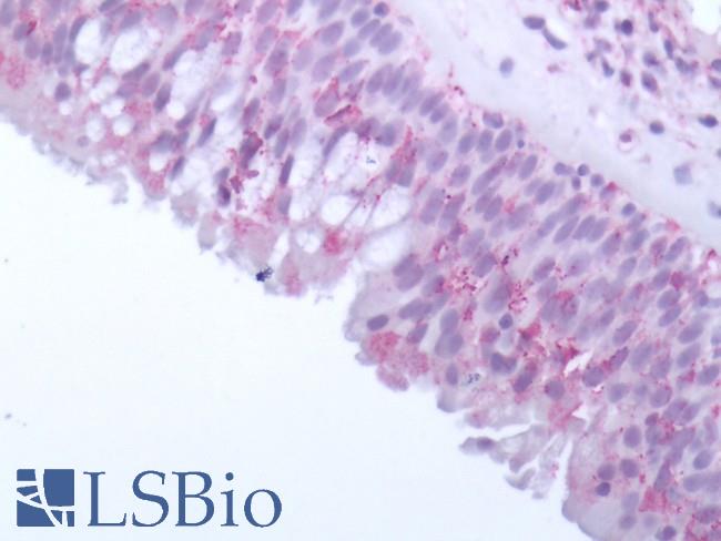OR10J5 Antibody - Human Olfactory Mucosa: Formalin-Fixed, Paraffin-Embedded (FFPE)