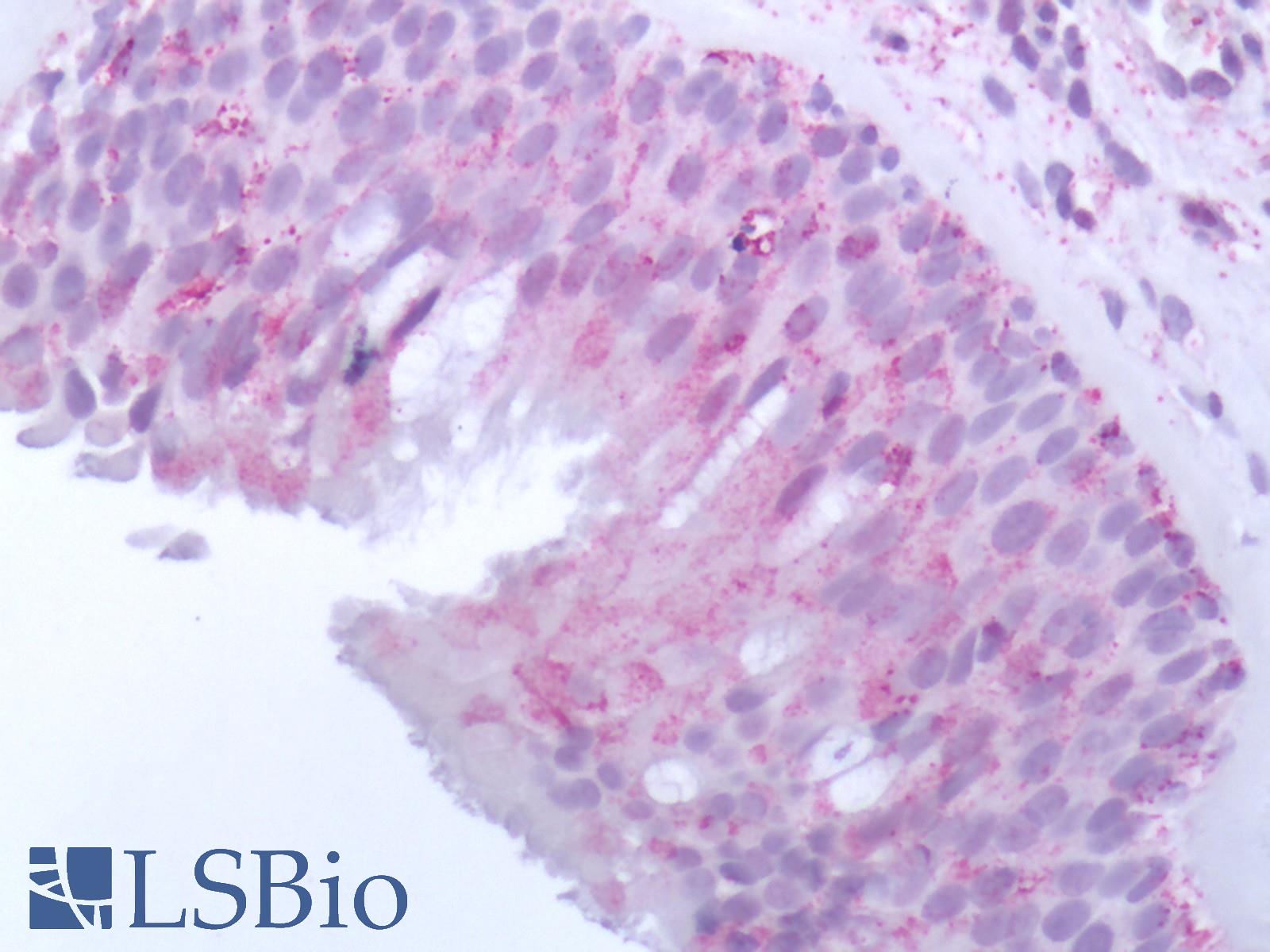 OR10J5 Antibody - Human Olfactory Mucosa: Formalin-Fixed, Paraffin-Embedded (FFPE)