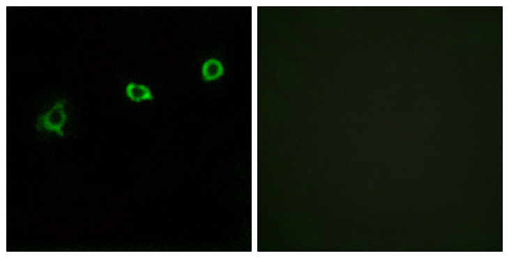 OR1N1 Antibody - Immunofluorescence analysis of HUVEC cells, using OR1N1 Antibody. The picture on the right is blocked with the synthesized peptide.