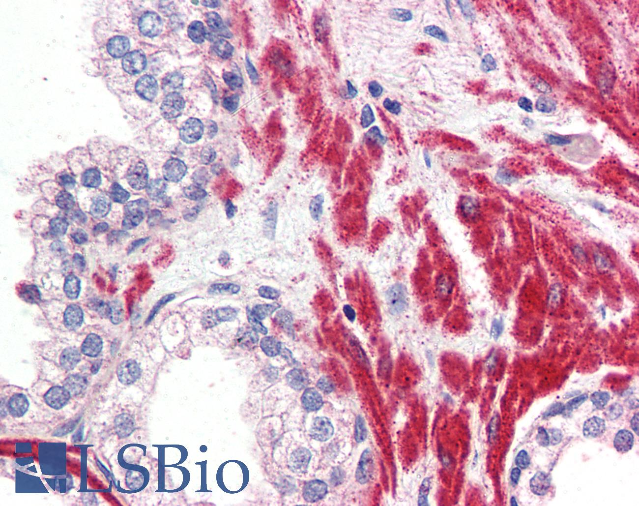 OR51E1 Antibody - Anti-OR51E1 antibody IHC of human prostate. Immunohistochemistry of formalin-fixed, paraffin-embedded tissue after heat-induced antigen retrieval.