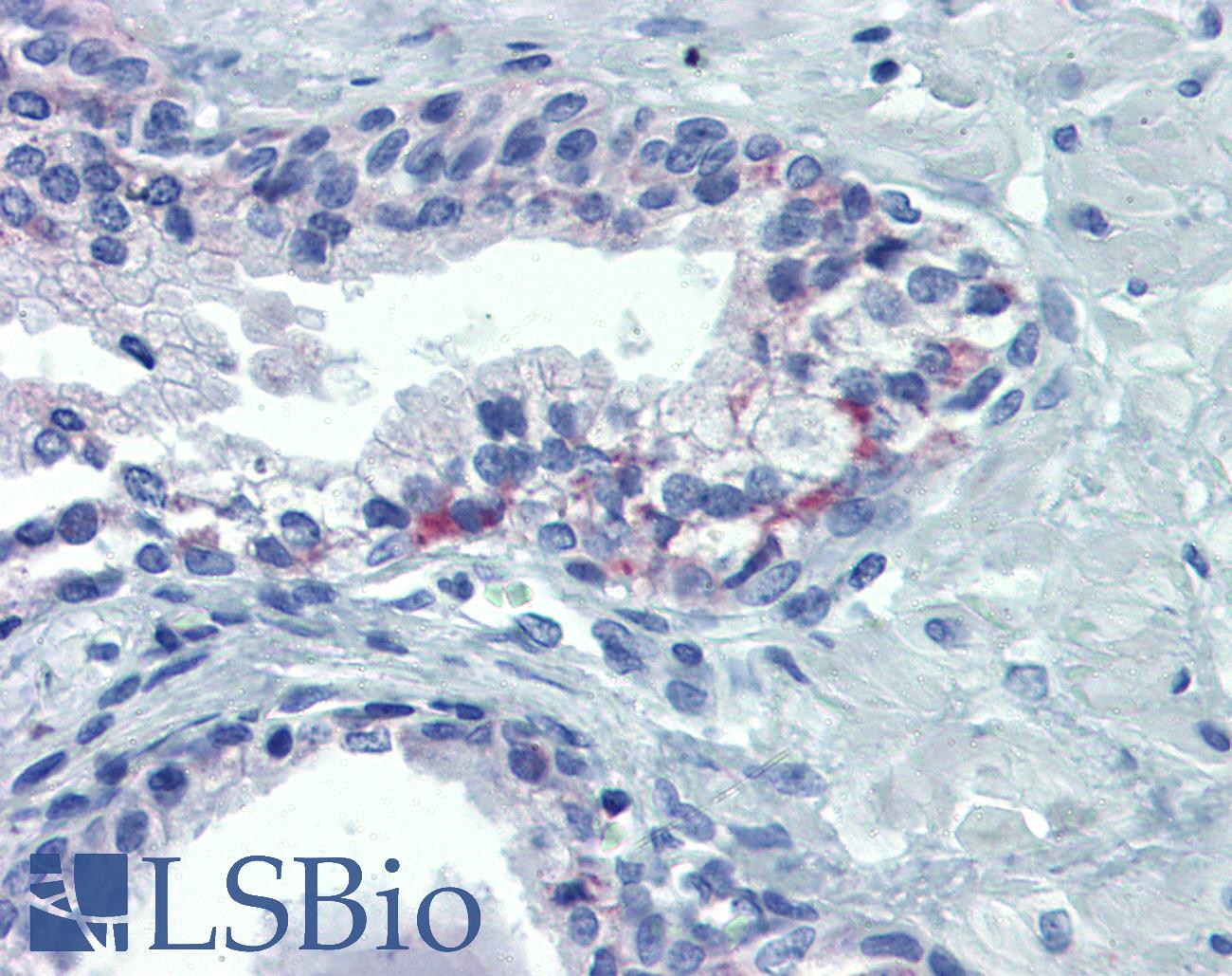 OR51E1 Antibody - Anti-OR51E1 antibody IHC of human prostate. Immunohistochemistry of formalin-fixed, paraffin-embedded tissue after heat-induced antigen retrieval. Antibody concentration 20 ug/ml.