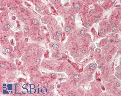 OR8D1 Antibody - Human Liver: Formalin-Fixed, Paraffin-Embedded (FFPE)