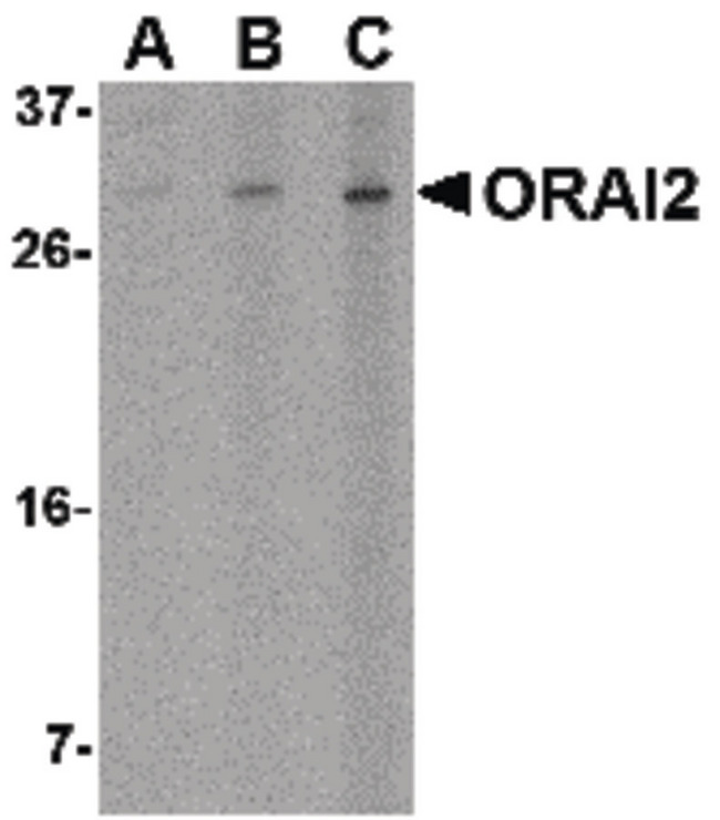 ORAI2 Antibody - Western blot of ORAI2 in Jurkat cell lysate with ORAI2 antibody at (A) 1, (B) 2 and (C) 4 ug/ml.