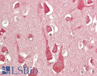 ORAI3 Antibody - Human Brain, Cortex: Formalin-Fixed, Paraffin-Embedded (FFPE)
