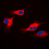 ORAOV1 Antibody - Immunofluorescent analysis of ORAOV1 staining in HeLa cells. Formalin-fixed cells were permeabilized with 0.1% Triton X-100 in TBS for 5-10 minutes and blocked with 3% BSA-PBS for 30 minutes at room temperature. Cells were probed with the primary antibody in 3% BSA-PBS and incubated overnight at 4 C in a humidified chamber. Cells were washed with PBST and incubated with a DyLight 594-conjugated secondary antibody (red) in PBS at room temperature in the dark. DAPI was used to stain the cell nuclei (blue).