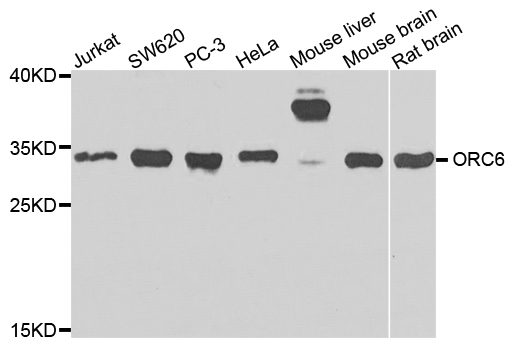 ORC6 / ORC6L Antibody - Western blot analysis of extracts of various cells.