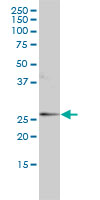 ORM1 / Orosomucoid Antibody - ORM1 monoclonal antibody clone 2F9-1F10 Western blot of ORM1 expression in MCF-7.