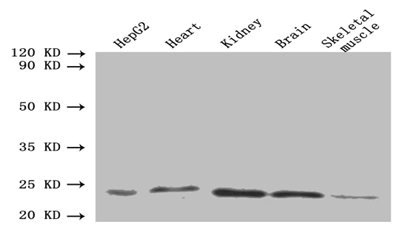 ORM2 / Orosomucoid 2 Antibody - Western blot All lanes: ORM2 antibody at 1.6µg/ml Lane 1: HepG2 whole cell lysate Lane 2: Mouse heart tissue Lane 3: Mouse kidney tissue Lane 4: Mouse brain tissue Lane 5: Mouse skeletal muscle tissue Secondary Goat polyclonal to rabbit IgG at 1/10000 dilution Predicted band size: 24 kDa Observed band size: 24 kDa
