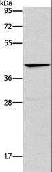 ORM2 / Orosomucoid 2 Antibody - Western blot analysis of Mouse liver tissue, using ORM2 Polyclonal Antibody at dilution of 1:500.