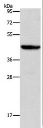 ORM2 / Orosomucoid 2 Antibody - Western blot analysis of Mouse liver tissue, using ORM2 Polyclonal Antibody at dilution of 1:700.