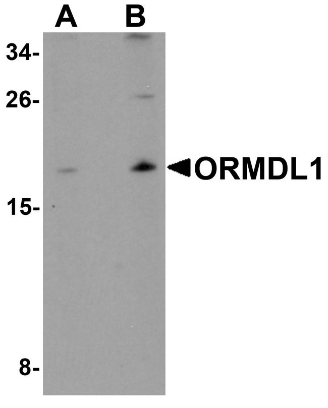ORMDL1 Antibody - Western blot analysis of ORMDL1 in SK-N-SH Cell lysate with ORMDL1 antibody at (A) 1 ug/ml and (B) 2 ug/ml.