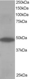 OSBPL1A / ORP1 Antibody - Antibody staining (0.5 ug/ml) of Human Muscle lysate (RIPA buffer, 35 ug total protein per lane). Primary incubated for 1 hour. Detected by Western blot of chemiluminescence.