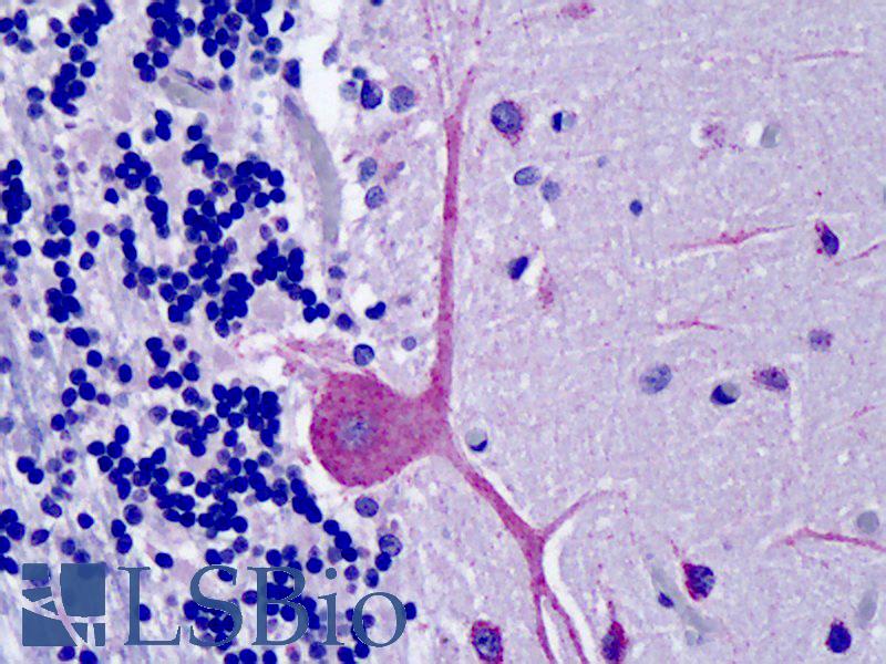 OSBPL1A / ORP1 Antibody - Anti-OSBPL1A / ORP1 antibody IHC of human brain, cerebellum. Immunohistochemistry of formalin-fixed, paraffin-embedded tissue after heat-induced antigen retrieval. Antibody concentration 5 ug/ml.
