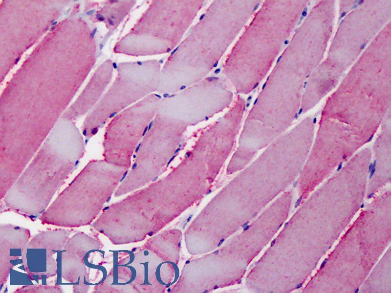 OSBPL1A / ORP1 Antibody - Anti-OSBPL1A / ORP1 antibody IHC of human skeletal muscle. Immunohistochemistry of formalin-fixed, paraffin-embedded tissue after heat-induced antigen retrieval. Antibody concentration 5 ug/ml.