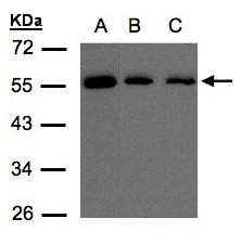 OSBPL2 Antibody - Sample (30 ug of whole cell lysate). A: H1299, B: Hep G2, C: MOLT4 . 10% SDS PAGE. OSBPL2 antibody diluted at 1:500