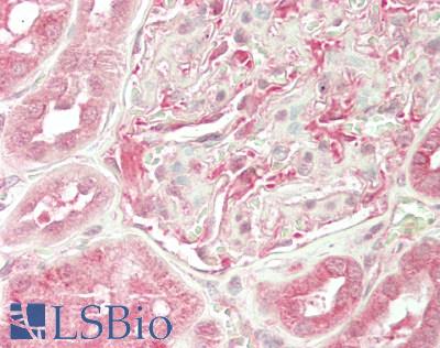 OSBPL2 Antibody - Human Kidney: Formalin-Fixed, Paraffin-Embedded (FFPE)