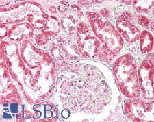 OSBPL5 Antibody - Human Kidney: Formalin-Fixed, Paraffin-Embedded (FFPE)