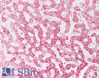 OSBPL5 Antibody - Human Liver: Formalin-Fixed, Paraffin-Embedded (FFPE)