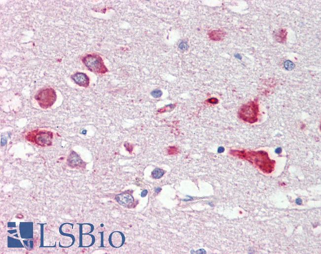 OSBPL9 Antibody - Anti-OSBPL9 antibody IHC of human brain, cortex. Immunohistochemistry of formalin-fixed, paraffin-embedded tissue after heat-induced antigen retrieval. Antibody concentration 2.5 ug/ml.