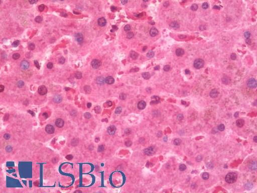 OSBPL9 Antibody - Anti-OSBPL9 antibody IHC staining of human liver. Immunohistochemistry of formalin-fixed, paraffin-embedded tissue after heat-induced antigen retrieval. Antibody concentration 7.5 ug/ml.