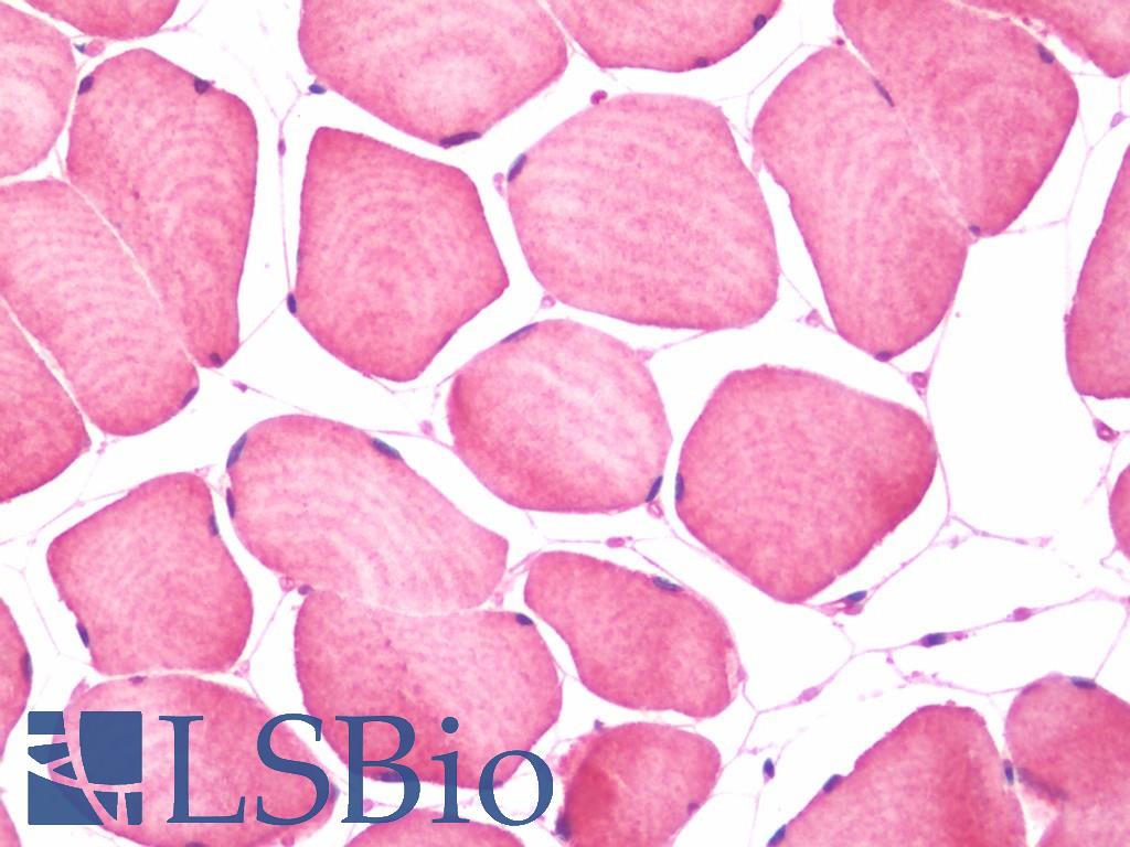 OSBPL9 Antibody - Anti-OSBPL9 antibody IHC staining of human skeletal muscle. Immunohistochemistry of formalin-fixed, paraffin-embedded tissue after heat-induced antigen retrieval.