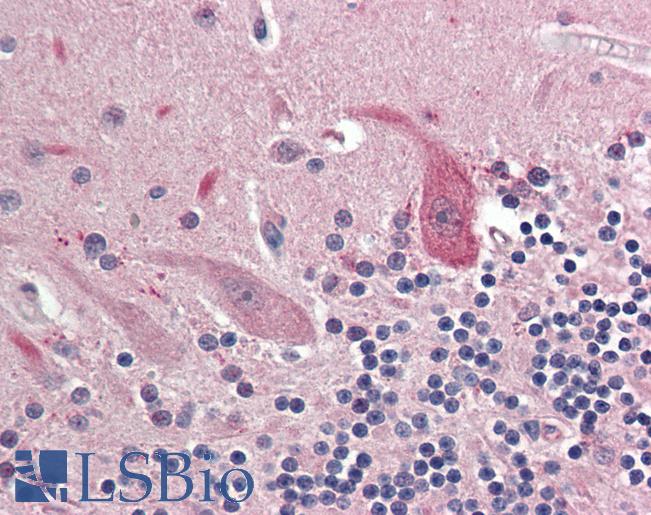 OSMR / IL-31R-Beta Antibody - Anti-OSMR antibody IHC staining of human brain, cerebellum. Immunohistochemistry of formalin-fixed, paraffin-embedded tissue after heat-induced antigen retrieval. Antibody concentration 10 ug/ml.  This image was taken for the unconjugated form of this product. Other forms have not been tested.