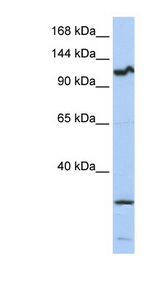 OSMR / IL-31R-Beta Antibody - OSMR / Oncostatin M Receptor antibody western blot of 721_B cell lysate.  This image was taken for the unconjugated form of this product. Other forms have not been tested.
