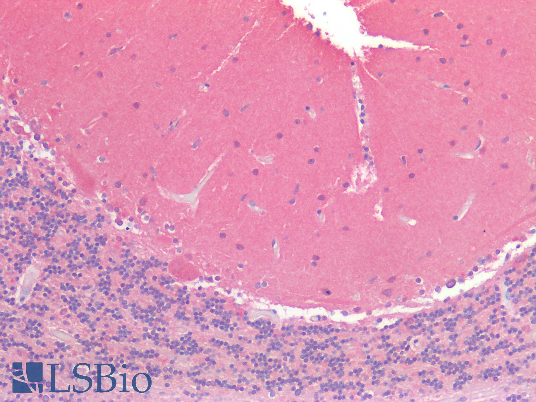 OSMR / IL-31R-Beta Antibody - Human Brain, Cerebellum: Formalin-Fixed, Paraffin-Embedded (FFPE)