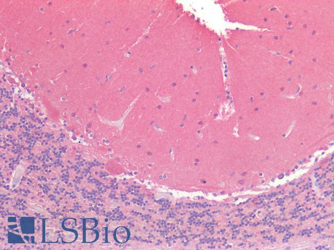 OSMR / IL-31R-Beta Antibody - Human Brain, Cerebellum: Formalin-Fixed, Paraffin-Embedded (FFPE)
