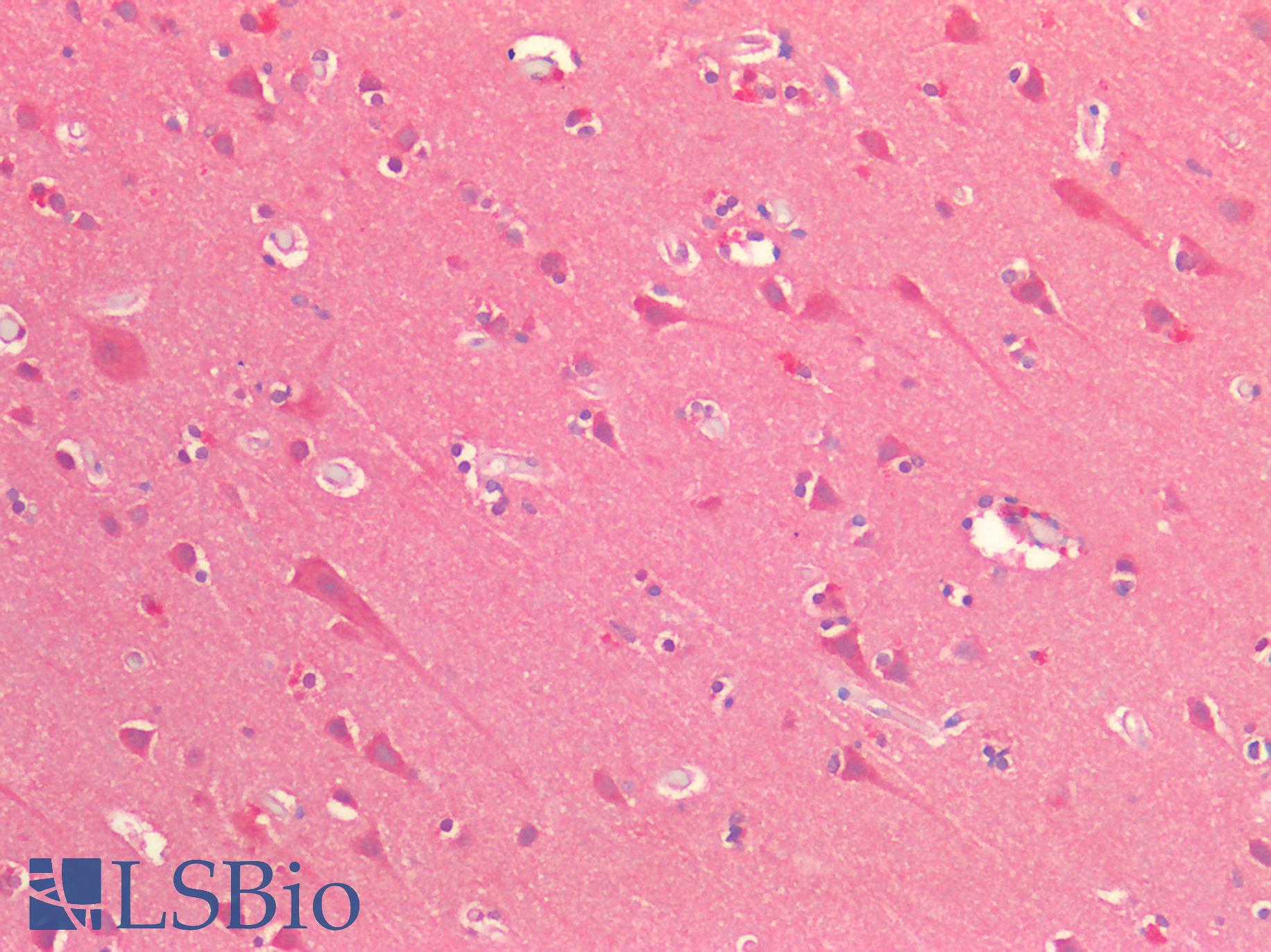 OSMR / IL-31R-Beta Antibody - Human Brain, Cortex: Formalin-Fixed, Paraffin-Embedded (FFPE)