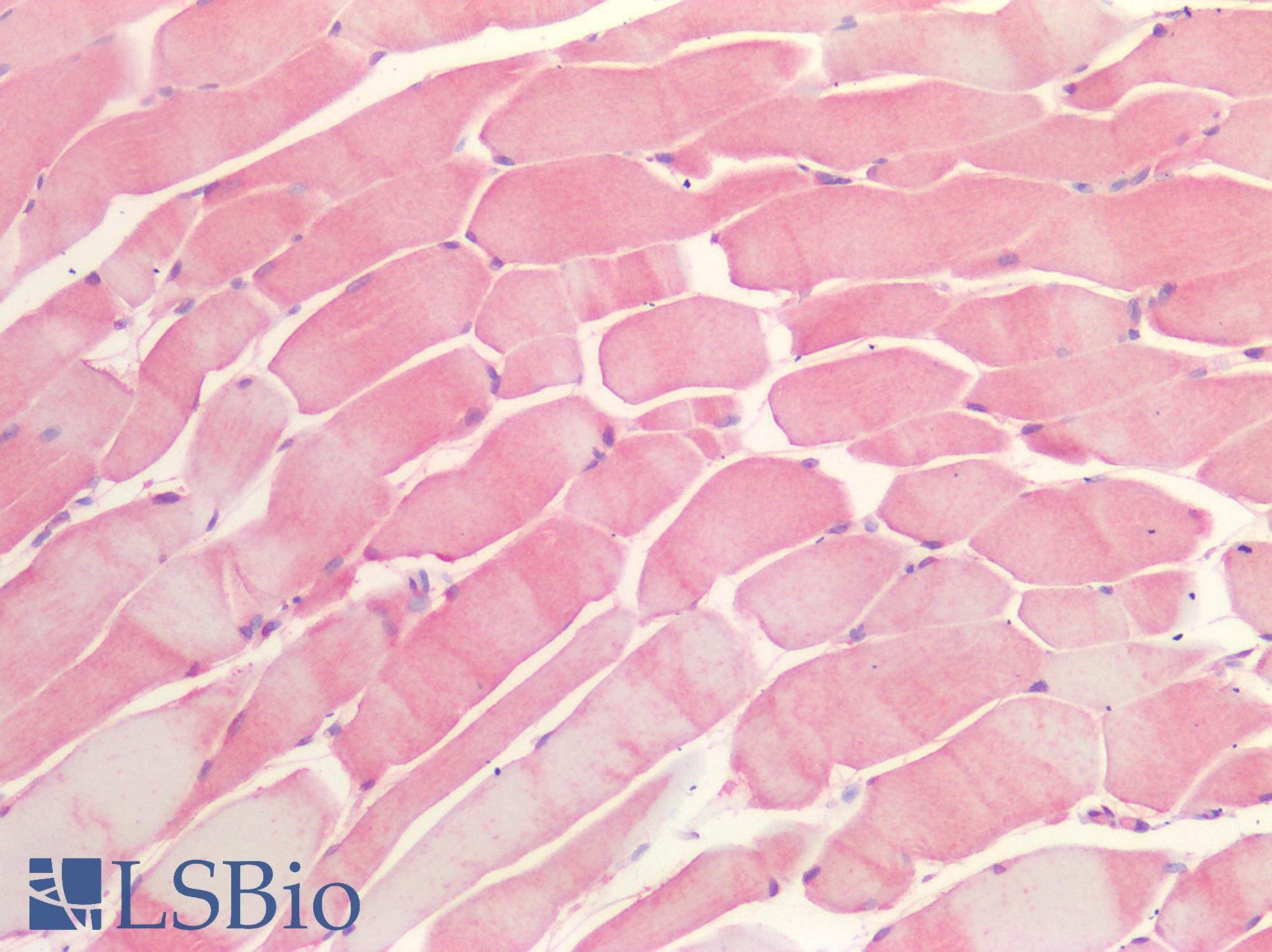 OSMR / IL-31R-Beta Antibody - Human Skeletal Muscle: Formalin-Fixed, Paraffin-Embedded (FFPE)