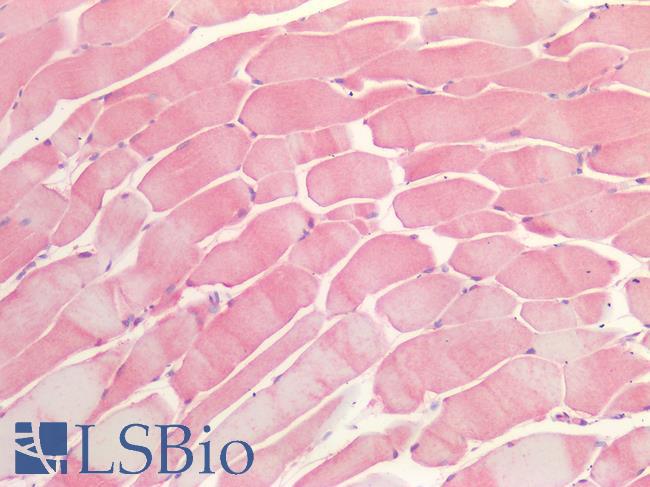 OSMR / IL-31R-Beta Antibody - Human Skeletal Muscle: Formalin-Fixed, Paraffin-Embedded (FFPE)