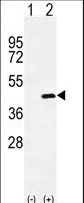 Osteoglycin / Mimecan Antibody - Western blot of OGN (arrow) using rabbit polyclonal OGN Antibody. 293 cell lysates (2 ug/lane) either nontransfected (Lane 1) or transiently transfected (Lane 2) with the OGN gene.