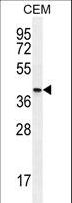 Osteoglycin / Mimecan Antibody - OGN Antibody western blot of CEM cell line lysates (35 ug/lane). The OGN antibody detected the OGN protein (arrow).