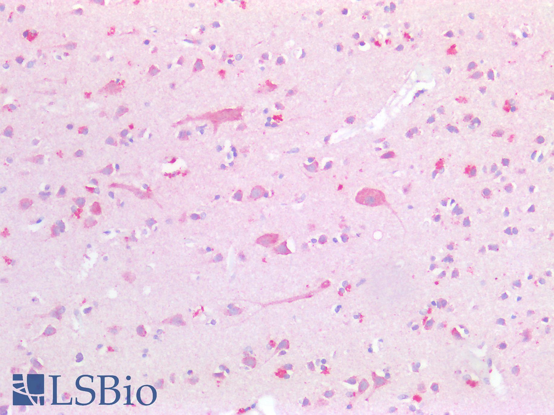 Osteonectin / SPARC Antibody - Human Brain, Cortex: Formalin-Fixed, Paraffin-Embedded (FFPE)