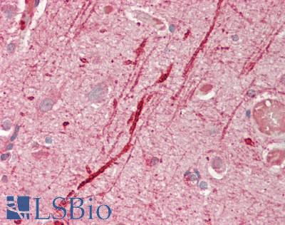 OSTN / Musclin / Osteocrin Antibody - Human Brain, Cortex: Formalin-Fixed, Paraffin-Embedded (FFPE)