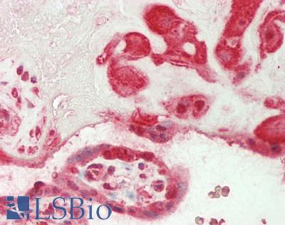 OSTN / Musclin / Osteocrin Antibody - Human Placenta: Formalin-Fixed, Paraffin-Embedded (FFPE)