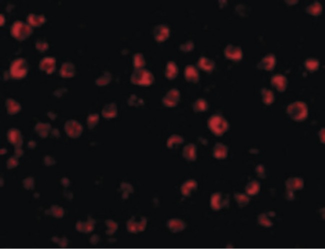 OTUD4 Antibody - Immunofluorescence of OTUD4 in Daudi cells with OTUD4 antibody at 20 ug/ml.