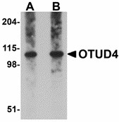 OTUD4 Antibody - Western blot of OTUD4 in Daudi cell lysate with OTUD4 antibody at (A) 0.25 and (B) 0.5 ug/ml.