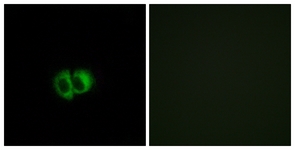 OXER1 Antibody - Immunofluorescence of MCF7 cells, using OXER1 Antibody. The picture on the right is treated with the synthesized peptide.