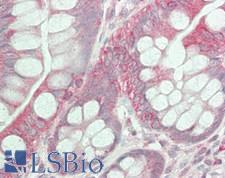 OXSR1 / OSR1 Antibody - Human Small Intestine: Formalin-Fixed, Paraffin-Embedded (FFPE)