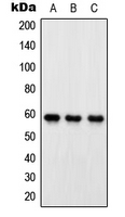 OXSR1 / OSR1 Antibody - Western blot analysis of OXSR1 expression in HeLa (A); SP2/0 (B); PC12 (C) whole cell lysates.