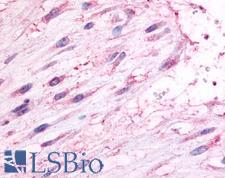 OXTR / Oxytocin Receptor Antibody - Anti-Oxytocin Receptor antibody IHC of human uterus, pregnant. Immunohistochemistry of formalin-fixed, paraffin-embedded tissue after heat-induced antigen retrieval.