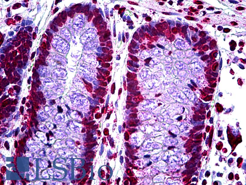 p16INK4a / CDKN2A Antibody - Anti-p16INK4A antibody IHC of human colon, crypt. Immunohistochemistry of formalin-fixed, paraffin-embedded tissue after heat-induced antigen retrieval. Antibody concentration 5 ug/ml.