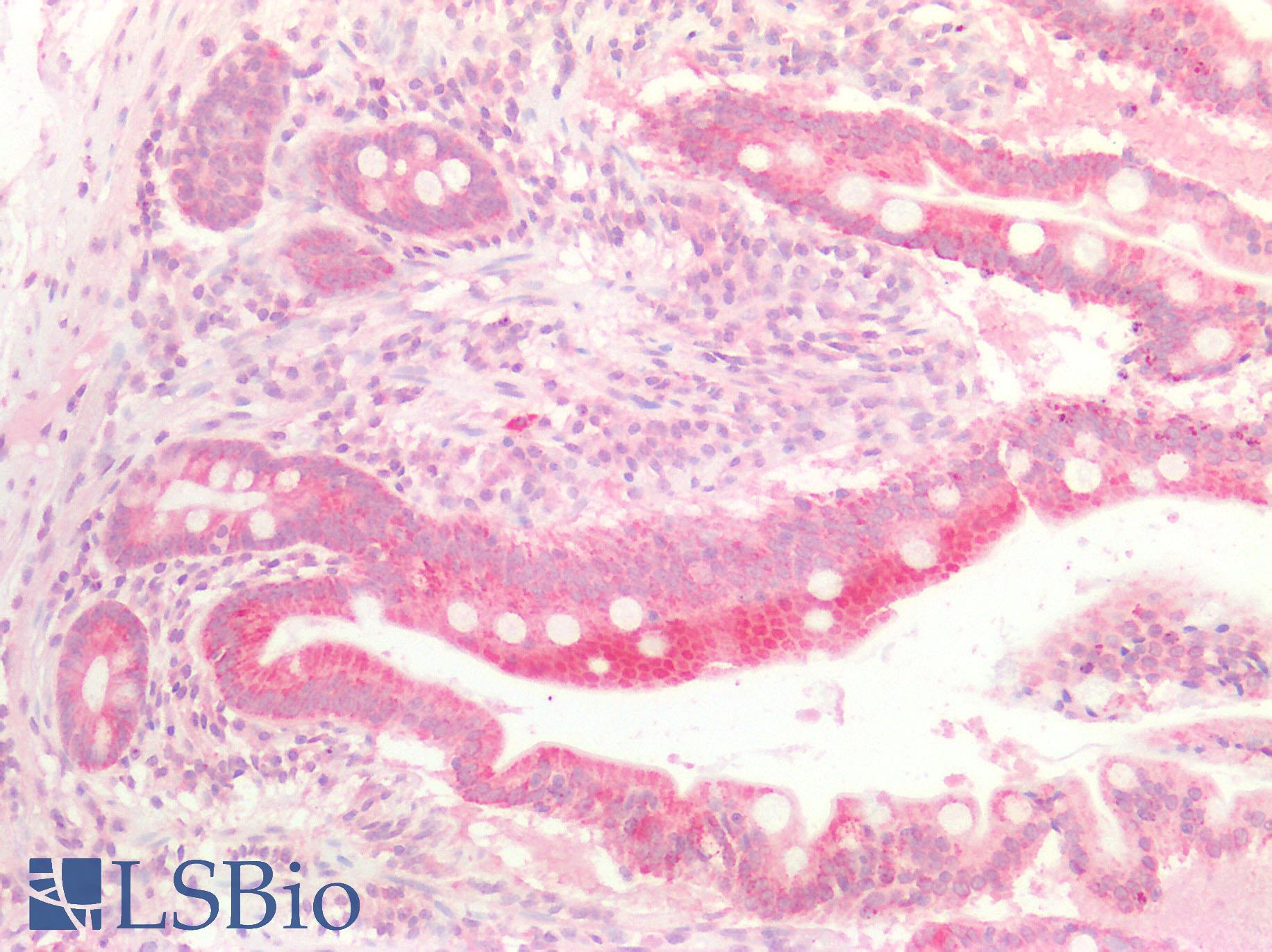 p16INK4a / CDKN2A Antibody - Anti-p16INK4A antibody IHC of human small intestine. Positive staining observed within the absorptive epithelium bordering the villi. Less staining observed within the lamina propria.   Immunohistochemistry of formalin-fixed, paraffin-embedded tissue after heat-induced antigen retrieval.