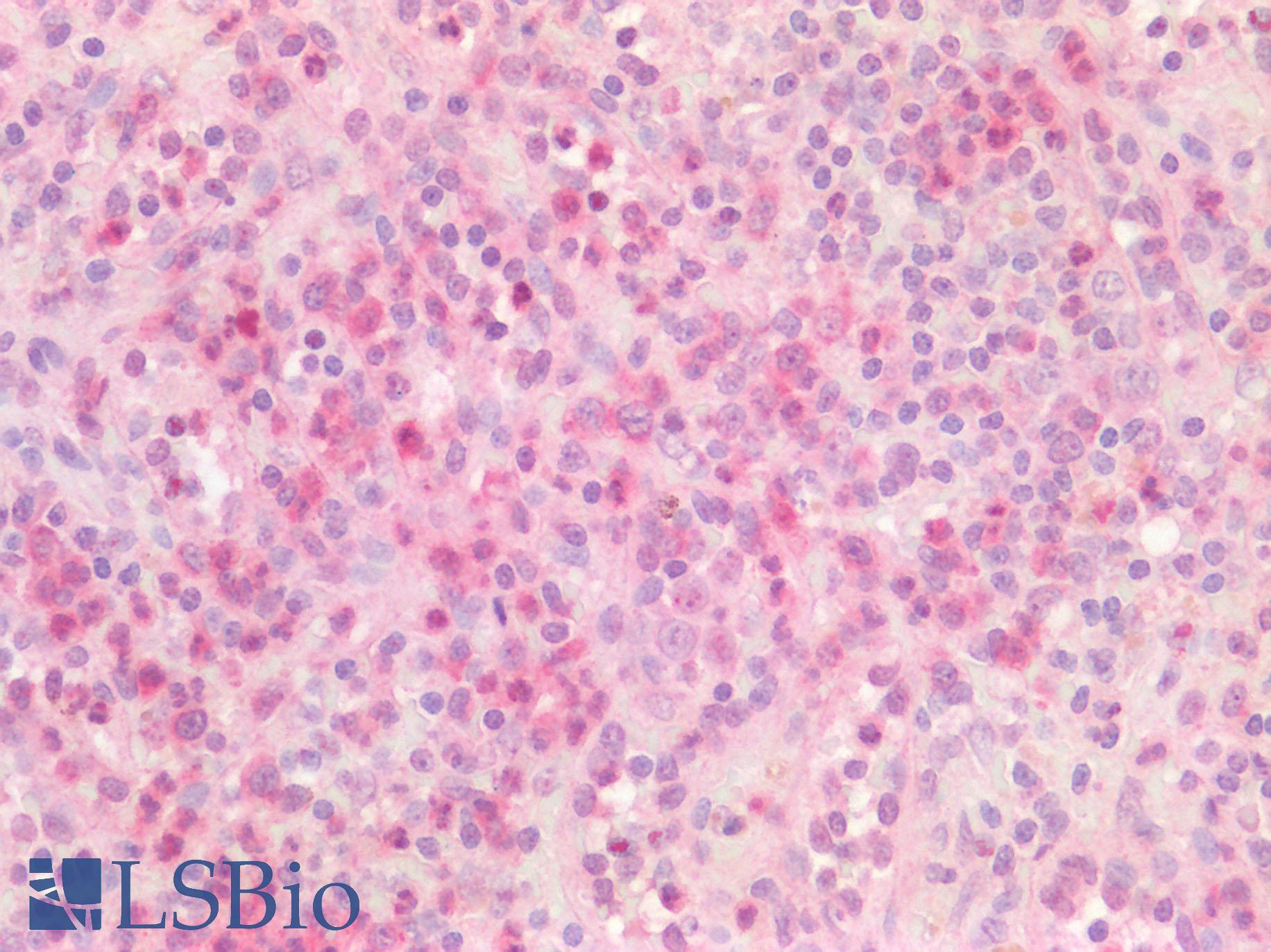 p16INK4a / CDKN2A Antibody - Anti-p16INK4A antibody IHC of human spleen. Positive staining observed within a subset of lymphocytes.  Immunohistochemistry of formalin-fixed, paraffin-embedded tissue after heat-induced antigen retrieval.