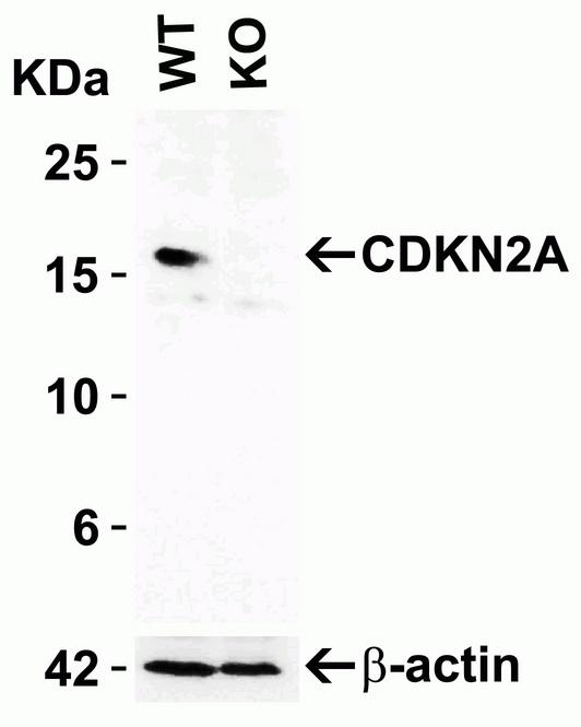 p16INK4a / CDKN2A Antibody - Loading: 10 µg of 293 WT cell lysates or KO cell lysates. Antibodies: LS-B1347 (2 µg/mL) and beta-actin (1 µg/mL), 1 h incubation at RT in 5% NFDM/TBST. Secondary: Goat Anti-Rabbit IgG HRP conjugate at 1:10000 dilution.
