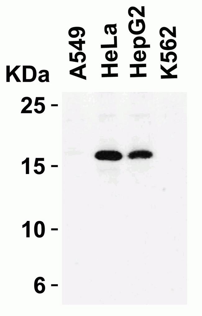 p16INK4a / CDKN2A Antibody - Loading: 15 µg of lysates per lane. Antibodies: LS-B1347 (2 µg/mL), 1 h incubation at RT in 5% NFDM/TBST. Secondary: Goat Anti-Rabbit IgG HRP conjugate at 1:10000 dilution.