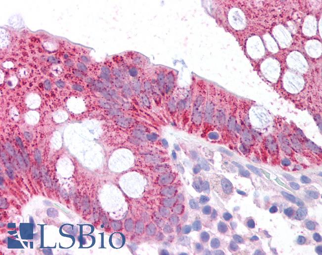 p16INK4a / CDKN2A Antibody - Anti-p16INK4A antibody IHC of human colon. Positive cytoplasmic staining within epithelial cells of the mucosa and no staining within the lamina propria. Immunohistochemistry of formalin-fixed, paraffin-embedded tissue after heat-induced antigen retrieval. Antibody concentration 5 µg/ml.